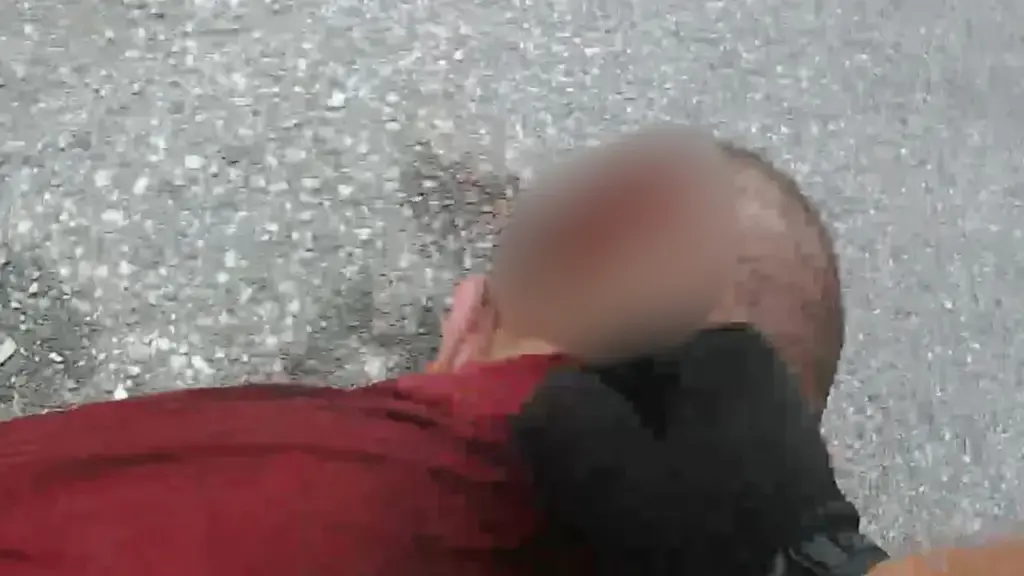 The bodycam frame showing the wound behind Fakir's head