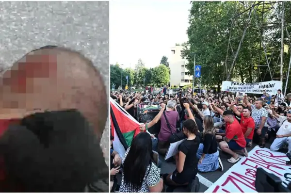 The injured nape, the 4 people helping the police officers: the last moments of Fakir in a frame from the bodycam
