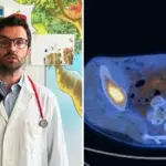 Soft tissue tumor, the revolutionary study: “This way bone marrow extraction in children can be avoided